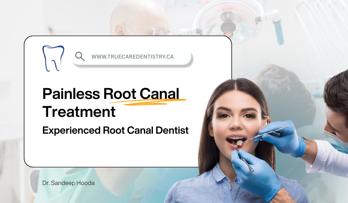 Best Root Canel Treatment